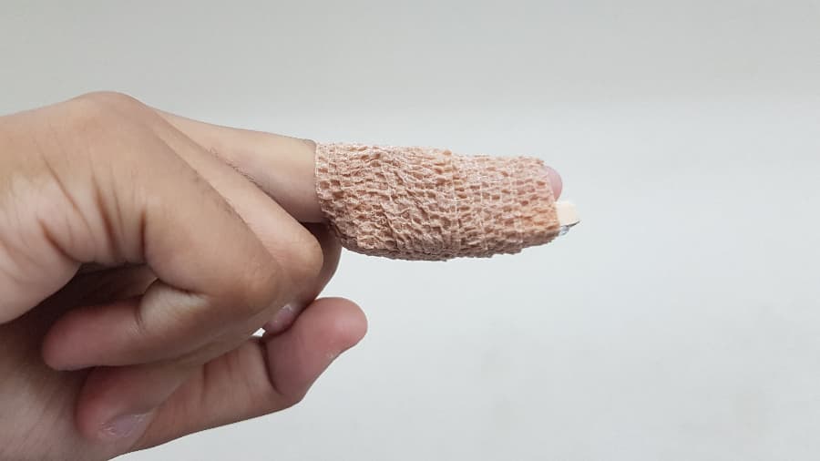 Finger in splint for mallet finger treatment